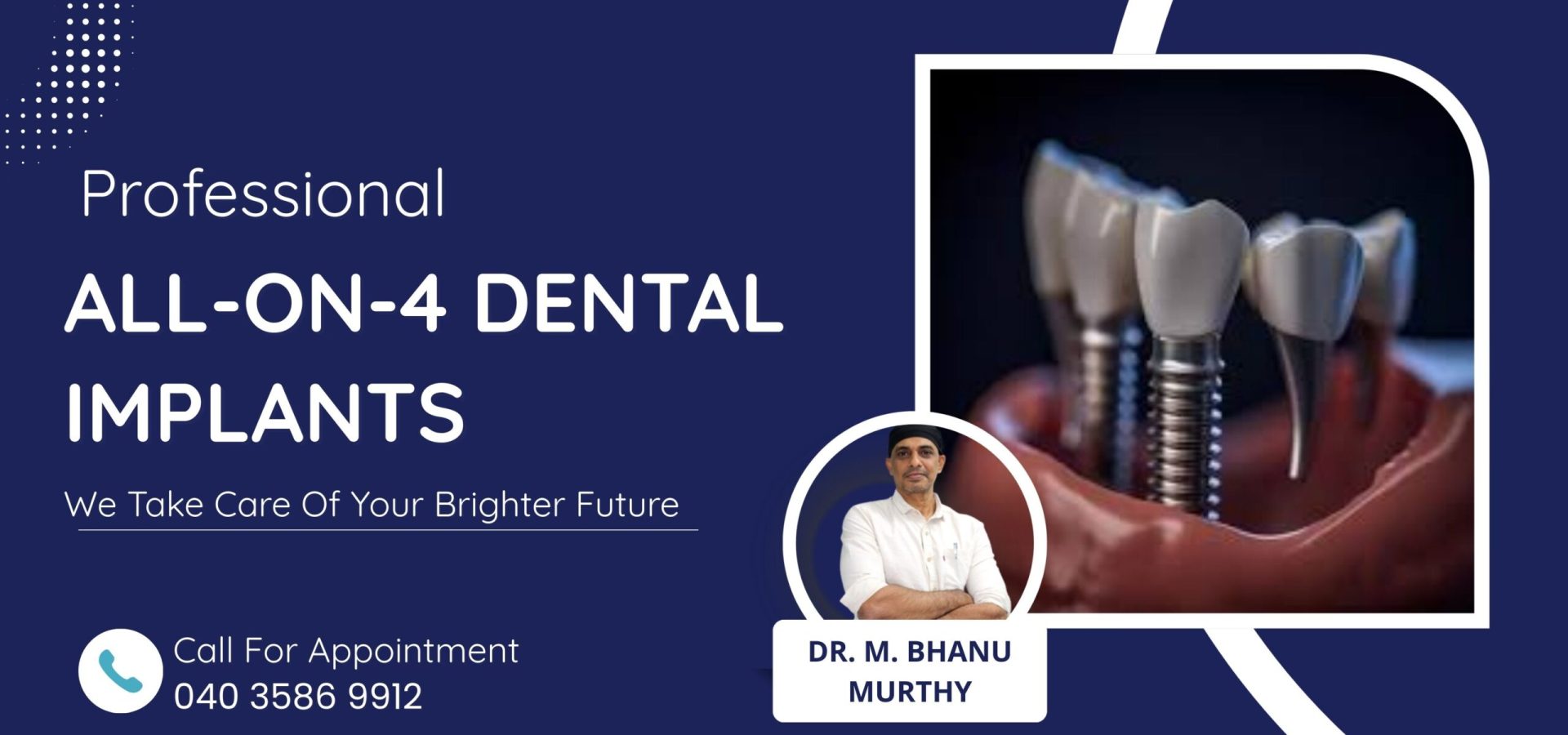 All-on-4 Dental Implants -baneer
